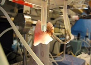 artificial organs